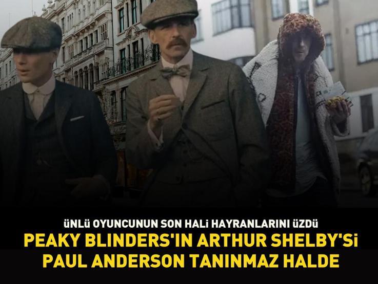 Peaky Blindersın Arthur Shelbysi Paul Anderson acınacak halde Dizideki karakteriyle aynı kaderi paylaşıyor