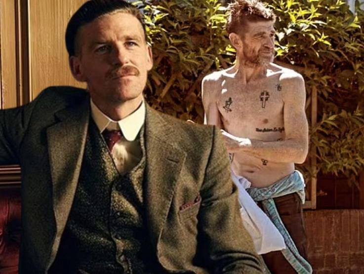 Peaky Blindersın Arthur Shelbysi Paul Anderson acınacak halde Dizideki karakteriyle aynı kaderi paylaşıyor