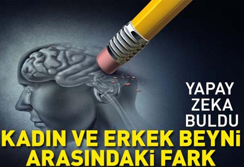 1500 kişi incelendi Yapay zeka erkek ve kadın beyinleri arasındaki farkı buldu: İşte sonuç