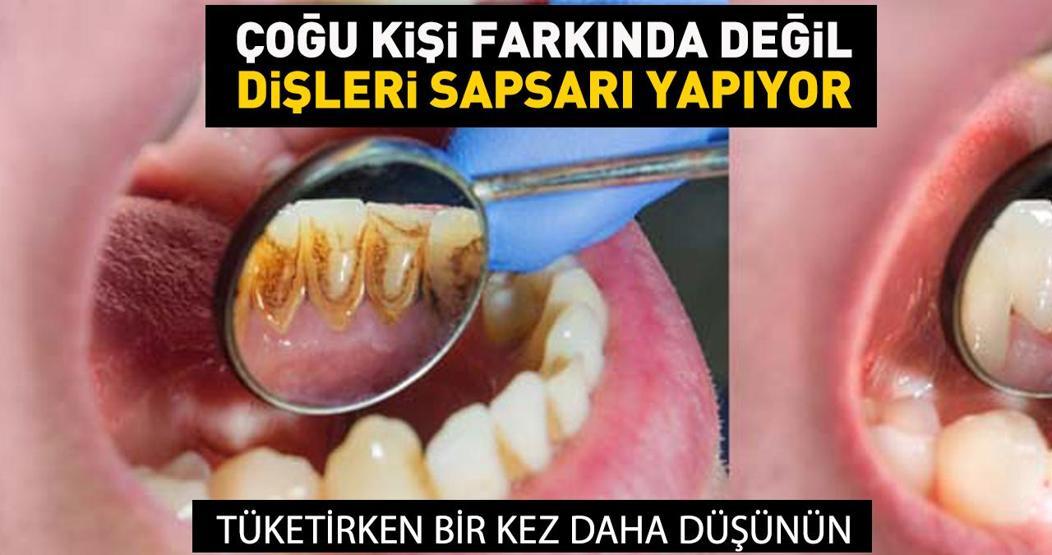 İnci gibi dişleri sapsarı yapıyor Tüketirken bir kez daha düşünün... Dişlere zarar veren 8 hatalı alışkanlık