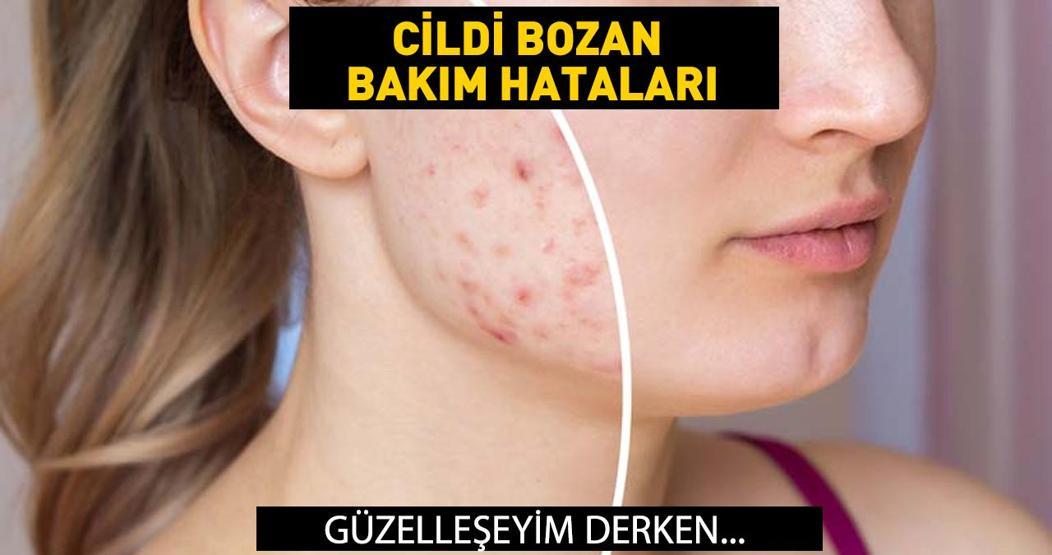 Dikkat Bu hatalar cildi bozuyor Bakım yapayım derken...