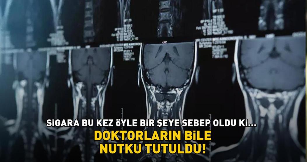Doktorlar bile şoke oldu Ses kısıklığı, öksürük, nefes almada zorluk Sigara bu kez öyle bir şeye sebep oldu ki...