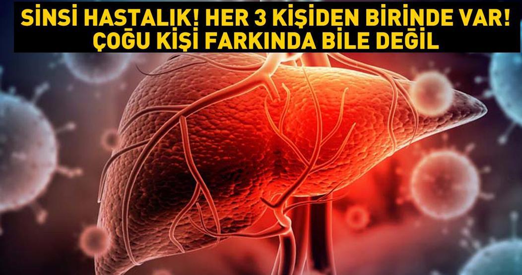 Sinsi hastalık Ülkemizde her 3 kişiden birinde var... Hastaların çoğu taşıyıcı olduğunun farkında bile değil Bulaş yollarına dikkat: Manikür, pedikür, kuaför, dövme...