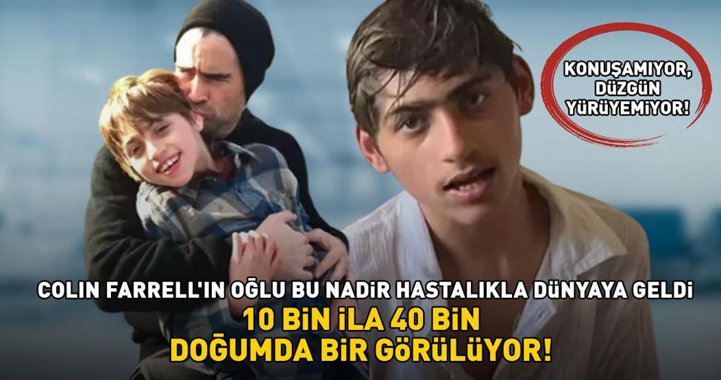 10 bin ila 40 bin doğumda bir görülüyor Colin Farrellın oğlu da bu nadir hastalıkla doğdu Konuşamıyor, düzgün yürüyemiyor