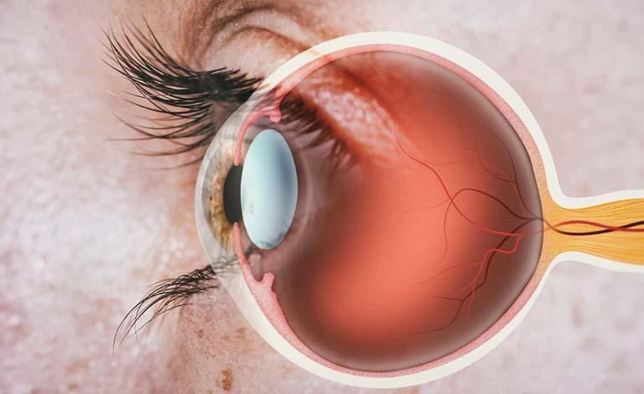 10-15 yaşlarında başlıyor, görme kaybına kadar gidiyor Çocuğunuz sürekli gözlerini ovalıyorsa sebebi bu tehlikeli hastalık olabilir