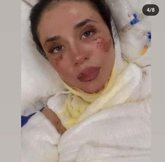 Hastanedeki patlamayla ilgili vahim iddia Hemşire arkadaşımız çakmağı yakarak sebep oldu