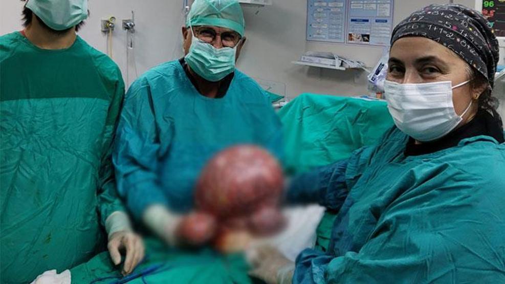Karın ağrısıyla hastaneye gitti Doktorlar görünce şoke oldu