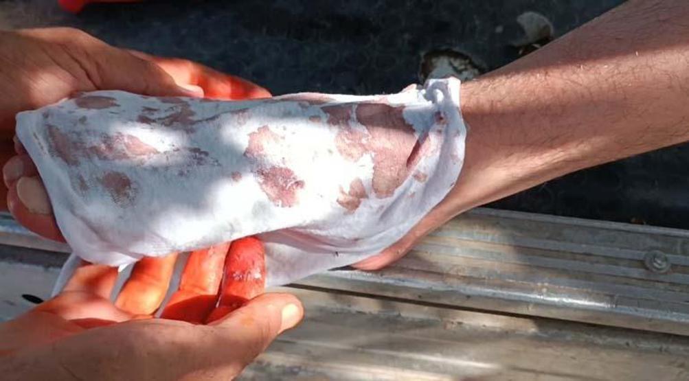 Tadı kekiğe benziyor Birçok derdin şifası Yüz felcinden kalp hastalığına iyi gelmediği şey yok...