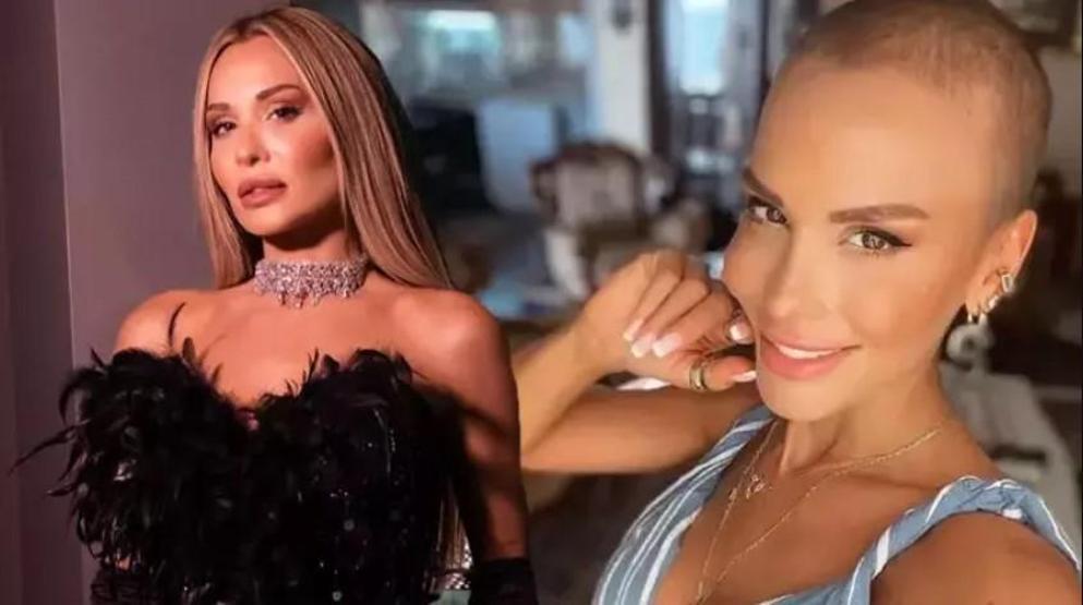 Şimal bir süredir sağlık sorunlarıyla mücadele ediyor Öncesi ve sonrası halini paylaştı