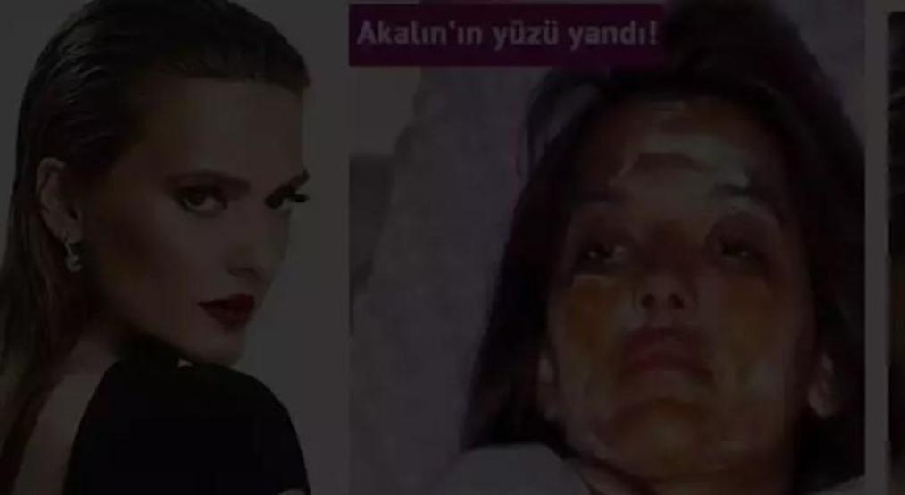 Masterchef Beyzanın olayından sonra Demet Akalın paylaştı Onun da başına gelmiş...
