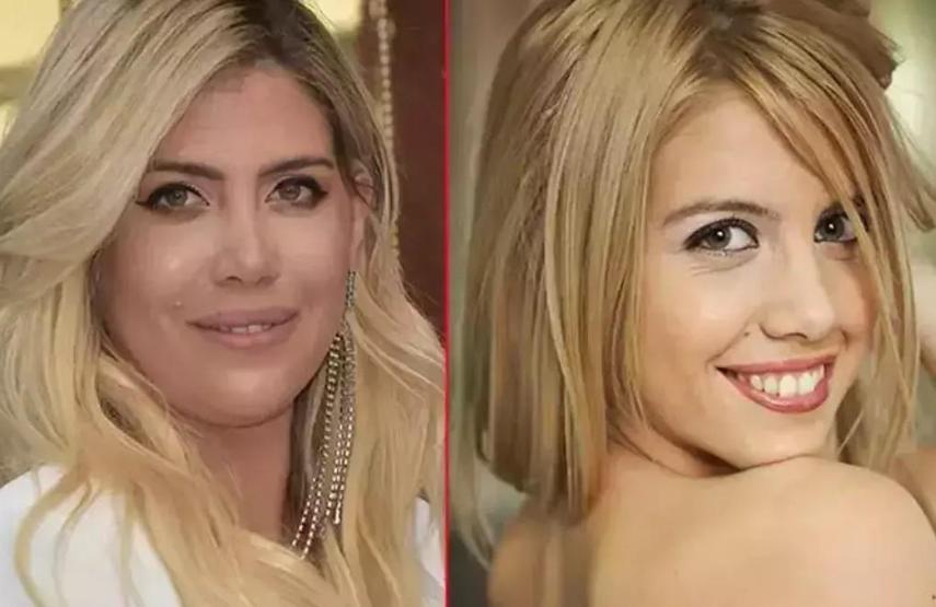 ESKİ HALİNİ GÖRENLER ONU TANIMAKTA GÜÇLÜK ÇEKTİ İşte Wanda Naranın estetiksiz hali...