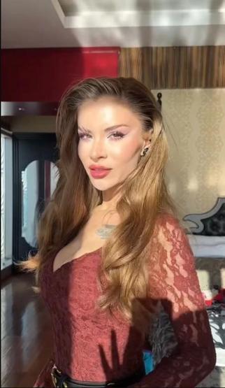 Feride Hilal Akının son hali şoke etti Estetik operasyonlarıyla tanınmaz hale geldi
