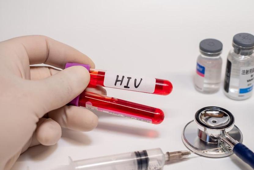 HIV POZİTİF NE DEMEK HIV nedir, nasıl bulaşır HIV ölümcül mü