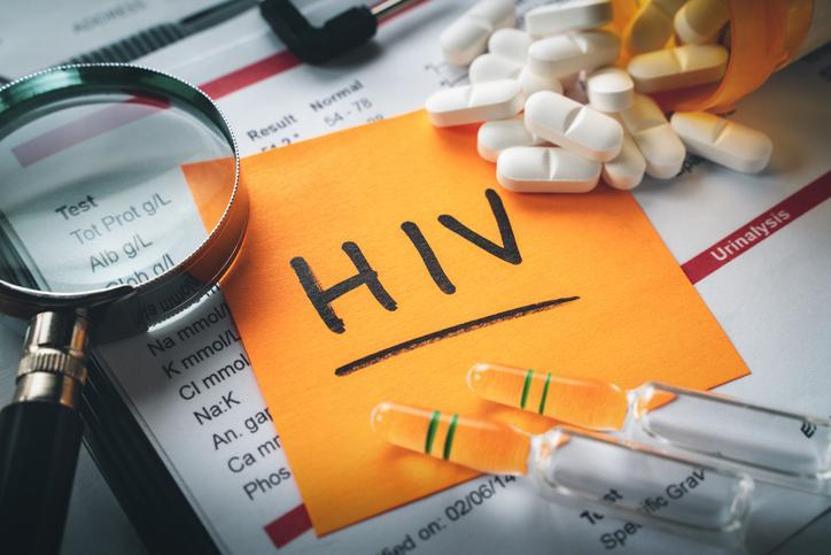 HIV POZİTİF NE DEMEK HIV nedir, nasıl bulaşır HIV ölümcül mü