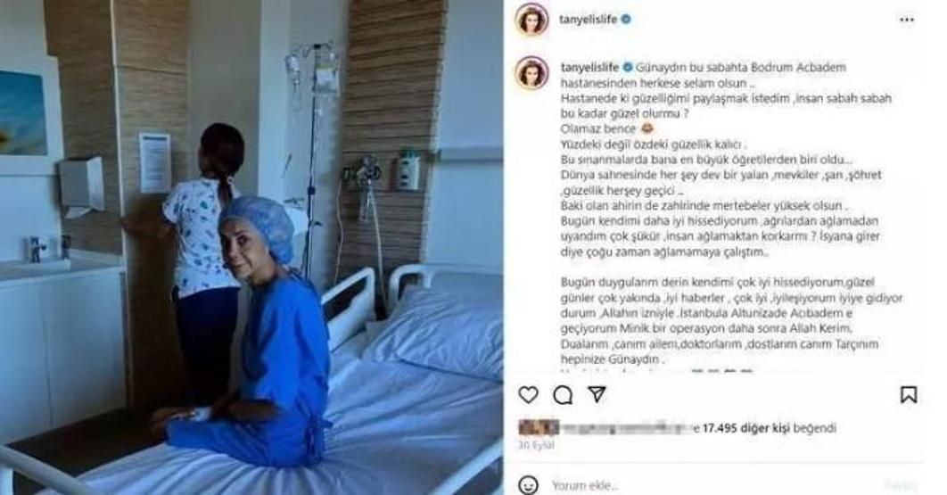 Kanserle mücadele eden Tanyeli bir ameliyat daha oldu İşte son durumu