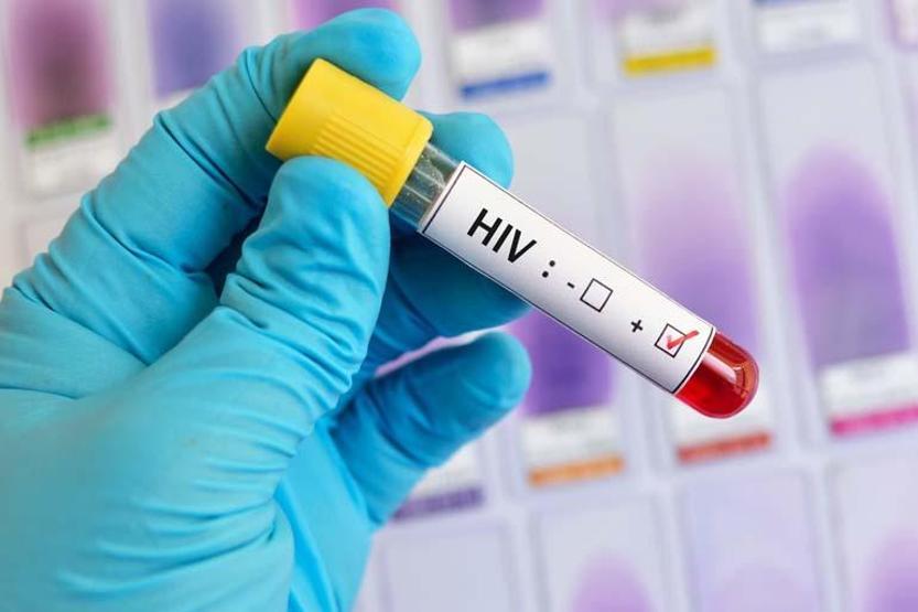 UNICEF’ten HIV uyarısı