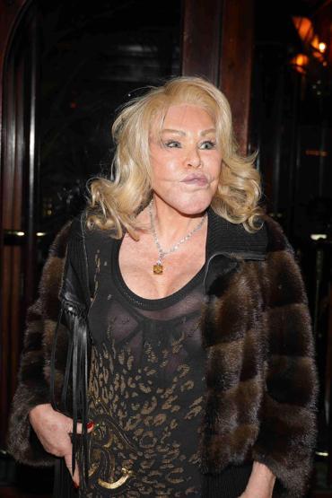 Kedi Kadın Jocelyn Wildenstein hayatını kaybetti: Ölüm nedeni açıklandı...