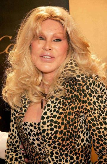 Kedi Kadın Jocelyn Wildenstein hayatını kaybetti: Ölüm nedeni açıklandı...