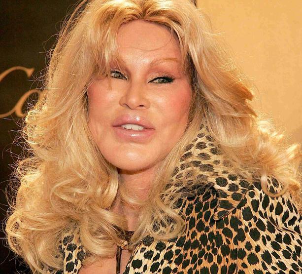 Kedi Kadın Jocelyn Wildenstein hayatını kaybetti: Ölüm nedeni açıklandı...
