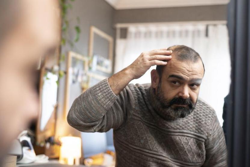 Saçlarınız avuç avuç dökülüyorsa dikkat Kökleri uyarıp besliyor, seyrelen kısımlarda yoğunluğu artırıyor