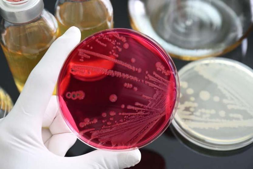 Gıda zehirlenmesinin gizli tehdidi: Salmonella Salmonella nedir, nasıl bulaşır