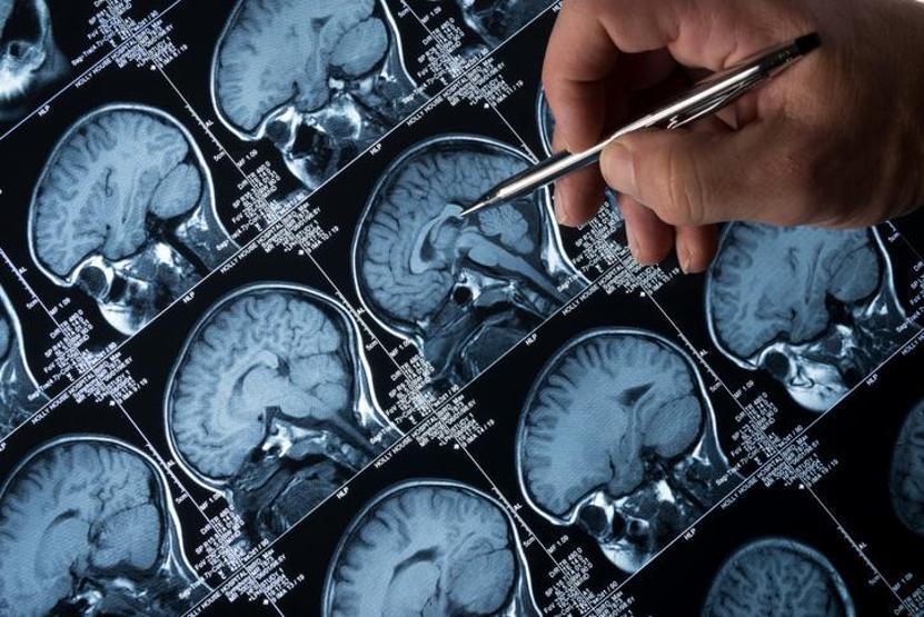 Depresyonda olduğunu sanıyordu, gerçek çok farklı çıktı Doktorlar bile şaşırdı TAM 7 SANTİMETRE BOYUNDA