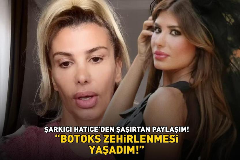 Şarkıcı Hatice neye uğradığını şaşırdı Şoke eden paylaşım: BOTOKS ZEHİRLENMESİ YAŞADIM