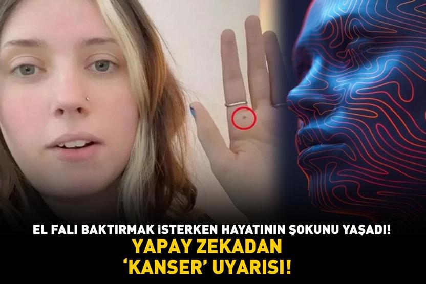YAPAY ZEKADAN ‘KANSER’ UYARISI El falı baktırmak isterken hayatının şokunu yaşadı Lenf nodlarına metastaz yapma riski yüksek