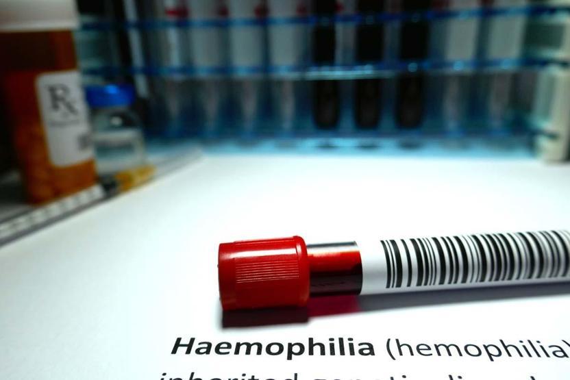 Hemofili hastalarına uyarı: Doktor kontrolleri aksatılmamalı