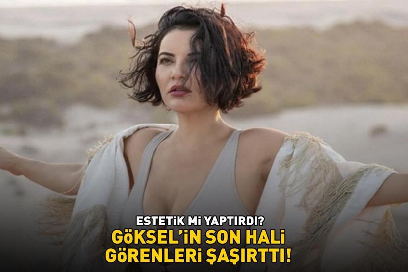 ESTETİK Mİ YAPTIRDI Gökselin son hali sosyal medyayı salladı