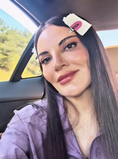 ESTETİK Mİ YAPTIRDI Gökselin son hali sosyal medyayı salladı