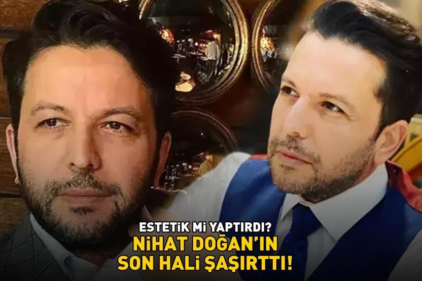 ESTETİK Mİ YAPTIRDI Nihat Doğanın son hali şoke etti