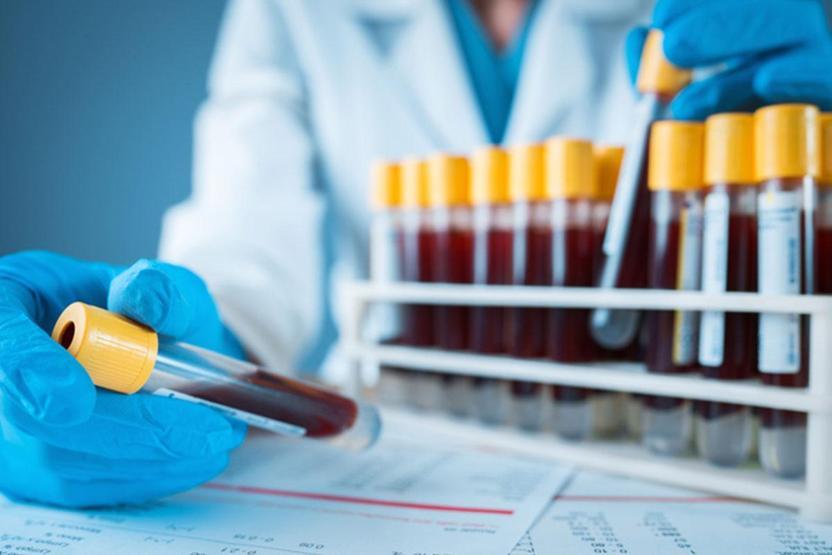 Ferritin Nedir Ferritin Seviyesi Nasıl Olmalı Yüksekliği ve Düşüklüğü Sağlığınızı Nasıl Etkiler