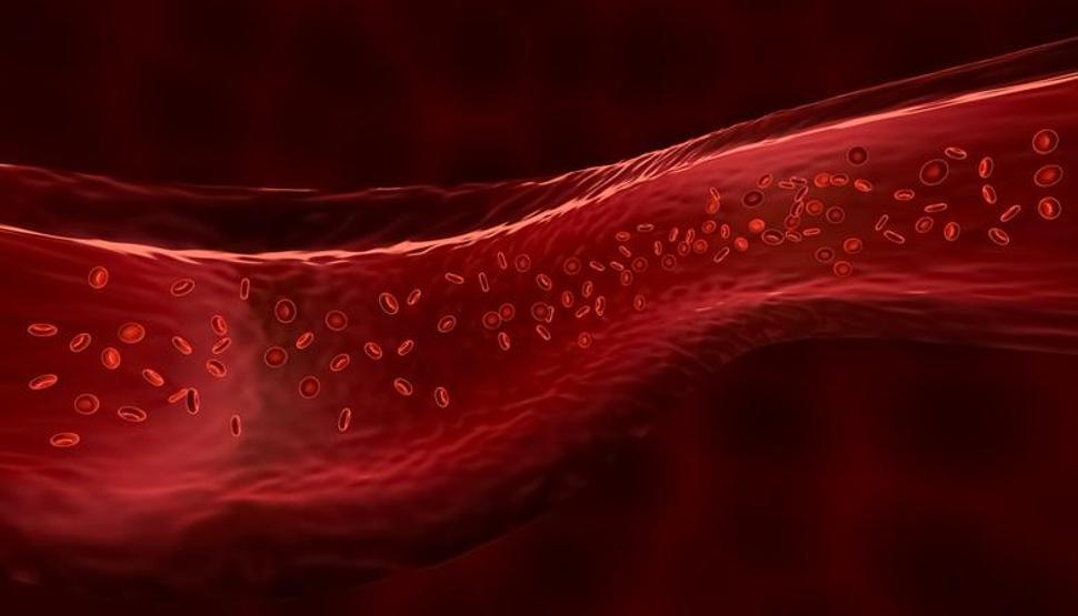 Ferritin Nedir Ferritin Seviyesi Nasıl Olmalı Yüksekliği ve Düşüklüğü Sağlığınızı Nasıl Etkiler