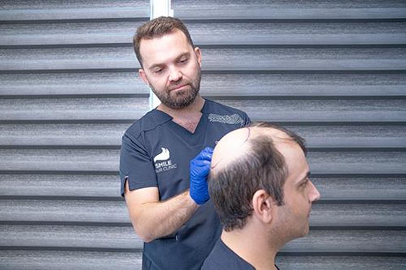 Hormonal saç dökülmesinde yaygın belirtiler