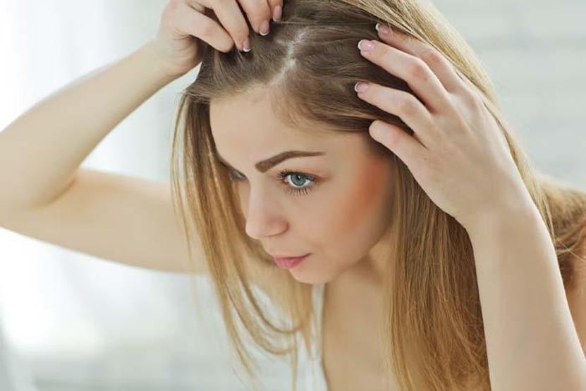 Hormonal saç dökülmesinde yaygın belirtiler