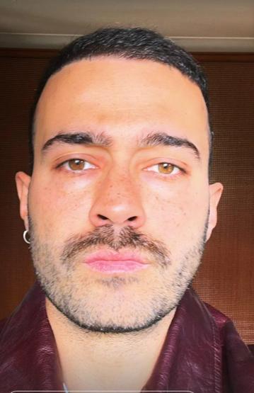 Serenay Sarıkayanın biricik aşkı Mert Demirin son hali şoke etti YENİ İMAJI OLAY OLDU