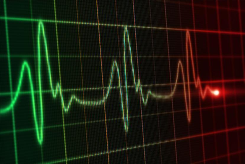 ANİ KALP KRİZİ RİSKİNİ YÜZDE 50 AZALTIYOR Uzman isim açıkladı: Maraton koşmaya gerek yok, az hareket bile büyük fark yaratır