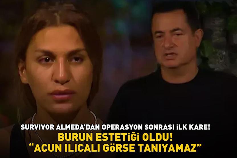 BURUN ESTETİĞİ OLDU Survivor Almeda sosyal medyayı 2ye böldü Acun Ilıcalı görse tanıyamaz