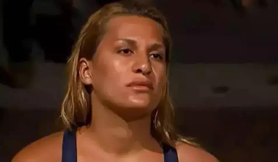 BURUN ESTETİĞİ OLDU Survivor Almeda sosyal medyayı 2ye böldü Acun Ilıcalı görse tanıyamaz