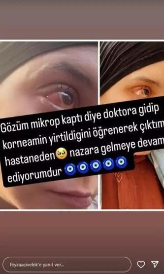 Göz Sağlığında Sorun Yaşayan Feyza Civelek’ten Endişelendiren Haber