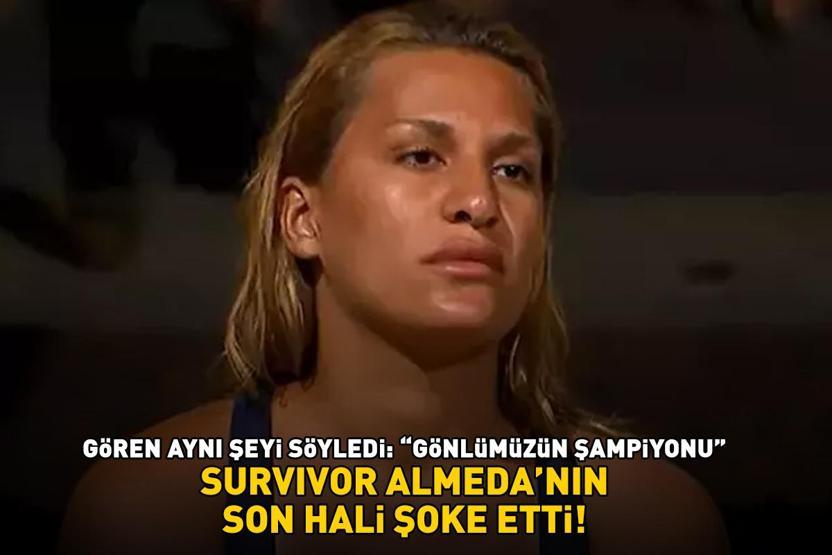 Survivor Almedanın son hali şoke etti Gören aynı şeyi söyledi: GÖNLÜMÜZÜN ŞAMPİYONU
