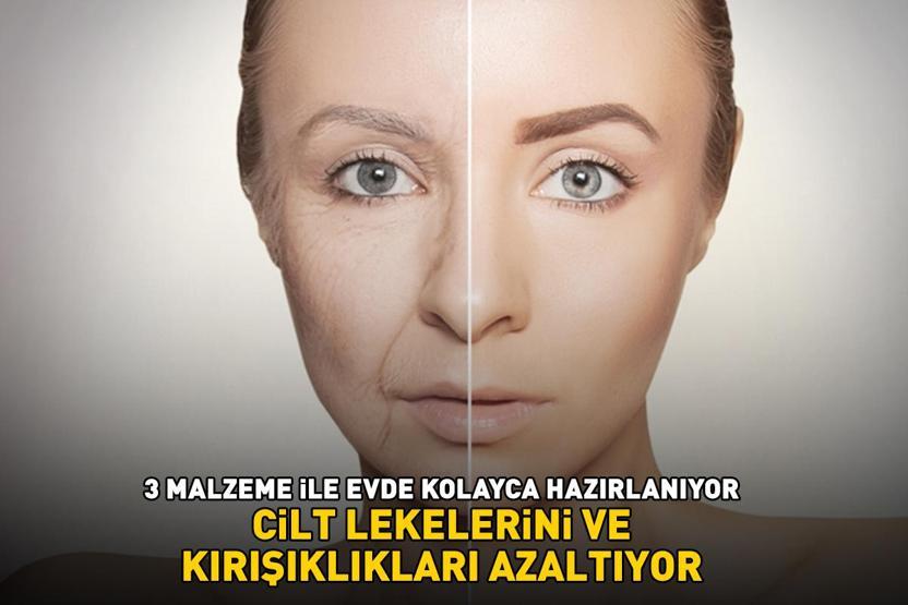 Bu yöntem güzelliğinize güzellik katacak Kırışıklıkları ütü gibi açıyor, cilt lekelerini yüzde 90 azaltıyor