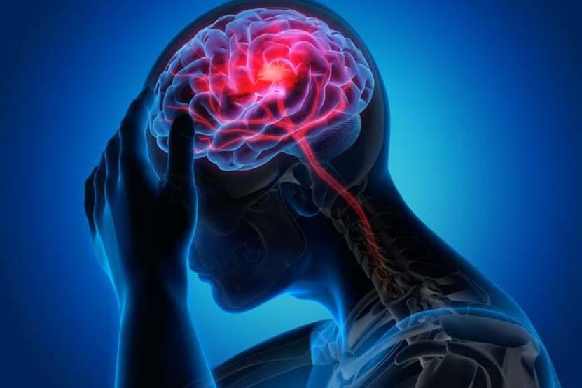 Çağın Kabusu: Beyin Damarlarında Birikerek Kan Akışını Engelliyor Alzheimer, Demans, İnme... Zihinsel Hastalıklarda Vakalar Patladı Mikroplastikler Beyinde Nasıl Birikiyor