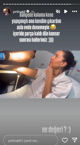 Pelin Akile kene şoku Hastanelik oldu Kolundan çıkarmaya çalışırken içeride parça kaldı