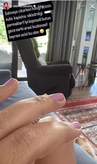 Talihsiz kaza Demet Akalın sevenlerini korkuttu: Bayram acısı bu olsun