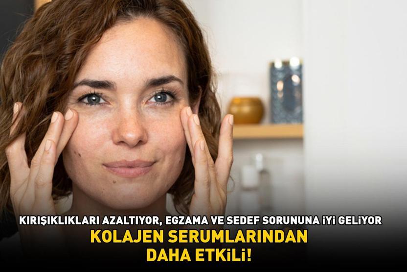 Kolajen serumlarından daha etkili 10 yaş birden gençleştiriyor: Kırışıklıkları ütü gibi açıyor, egzama ve sedefe iyi geliyor