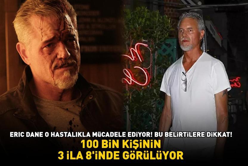 100 BİN KİŞİNİN 3 İLA 8İNDE GÖRÜLÜYOR Euphorianın yıldızı Eric Dane o hastalıkla mücadele ediyor Bu belirtilere dikkat