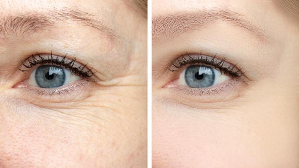 Güçlü antioksidan etkisi A, C, E ve B6 vitaminleri içeriyor Kırışıklıkları azaltıyor, kalp sağlığını koruyor