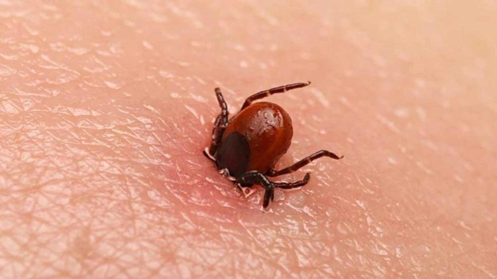KENE KOVUCU SPREY Bu karışım keneleri uzaklaştırıyor Keneye karşı doğal çözüm, etkili ilaç